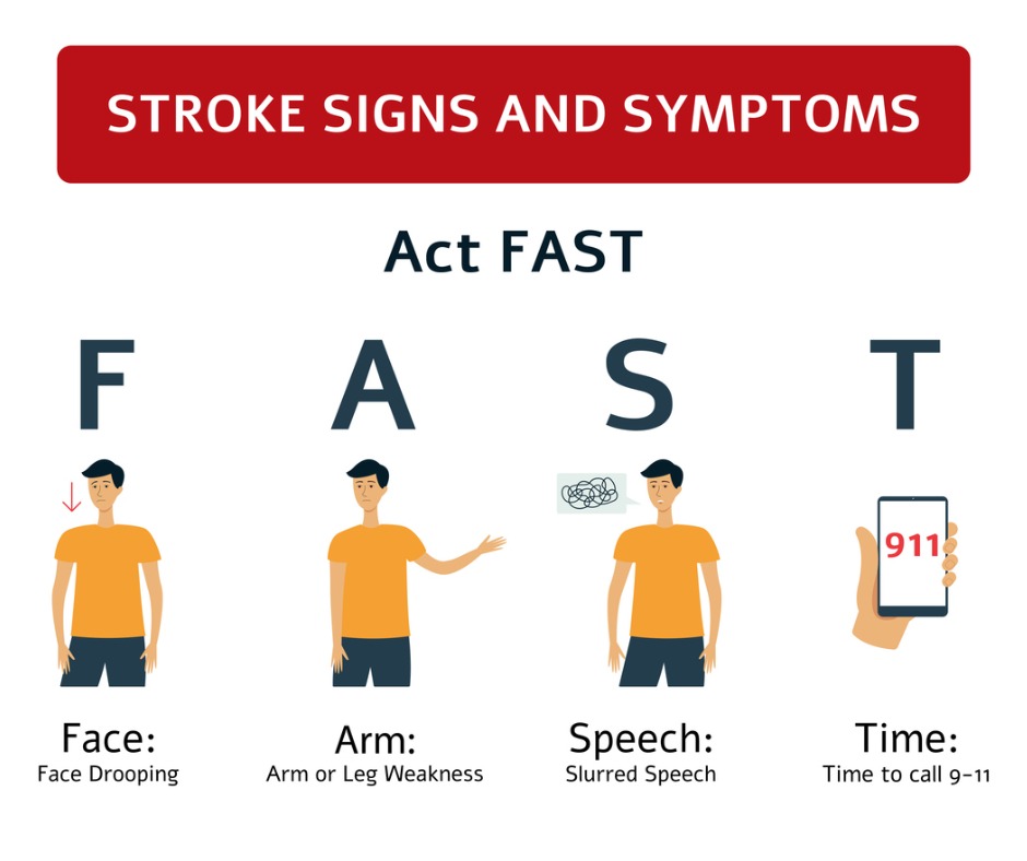 Stroke Signs and Symptoms: Act F.A.S.T. - Face Drooping, Arm or Leg Weakness, Slurred Speech, Time to call 911.